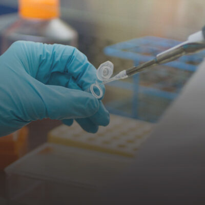 A researcher pipetting a sample in a life-science lab.