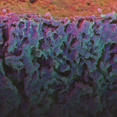 Microscope image of a biomaterial.