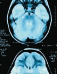 Image suggestive of a brain scan.