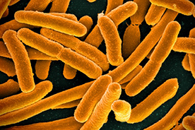 Micrograph of E. coli, courtesy of the NIH.