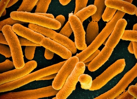 Micrograph of E. coli, courtesy of the NIH.