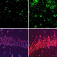 Amyloid and tau 850 1b