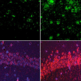 Amyloid and tau 850 1b