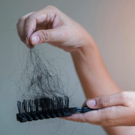 Hair loss brush list - Image for Why Stress Can Make Your Hair Fall Out