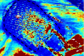 Luba Perry Doppler Image