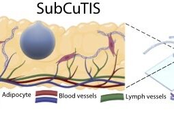 Subcu Tis Schematic