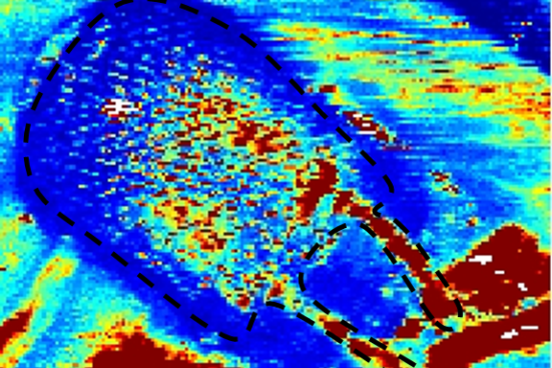 Luba Perry Doppler Image