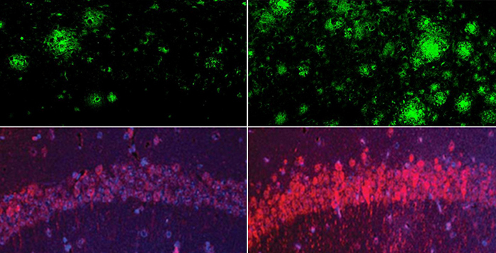 Amyloid and tau 850 1b