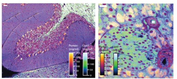 NoRI visualization and measurements of mouse cerebellum and pancreatic islet enabling quantitative pathology. (Credit: Kirschner Lab.)