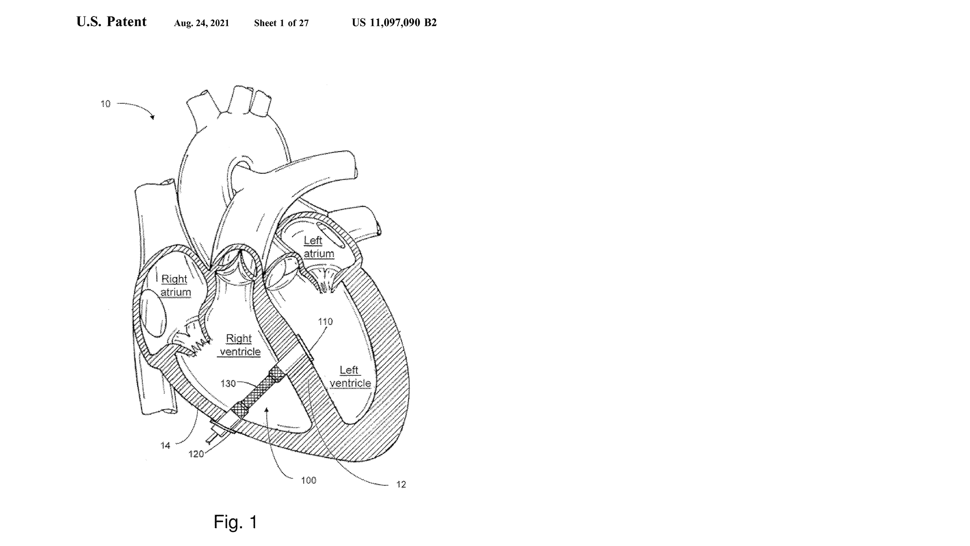 Heart device for dig display