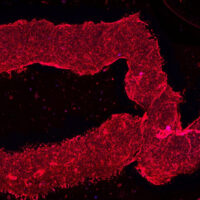 3D-printed living smooth muscle cells