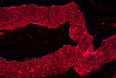 3D-printed living smooth muscle cells