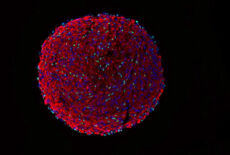 Skeletal muscle organoid