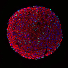 Skeletal muscle organoid