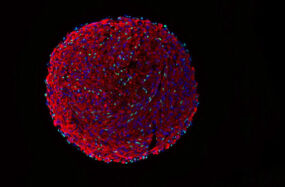 Skeletal muscle organoid