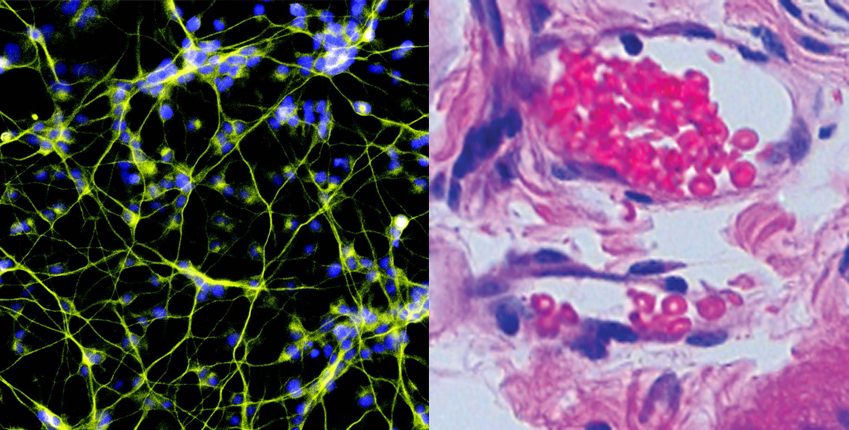 Functional neurons, left, and vascular endothelial cells, right, were derived from human pluripotent stem cells using the Human TFome technology.