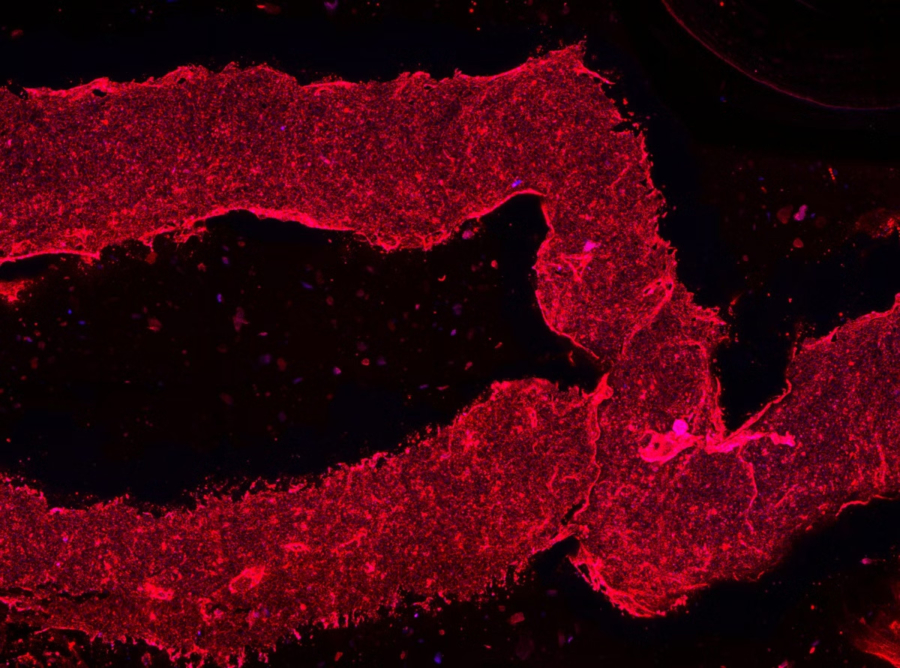 3D-printed living smooth muscle cells