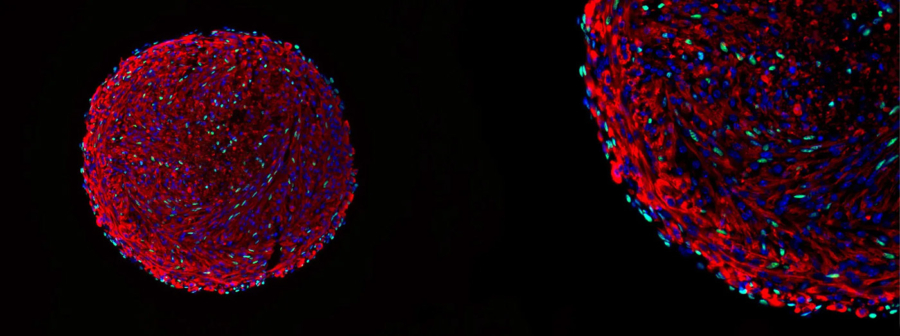 Skeletal muscle organoid