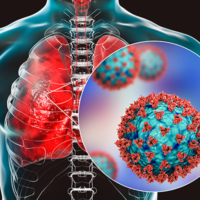 Stock image representative of COVID-19 infection affecting the lungs. (Credit: Shutterstock.)