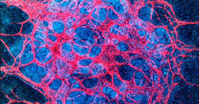 Harvard licenses kidney engineering technology to Trestle… - Vimarsana News