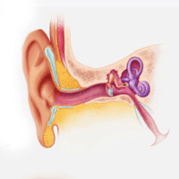 Illustration of how the PhonoGraft may be implanted in the ear canal.