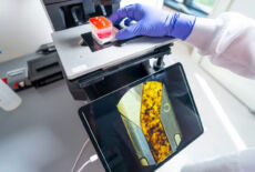 Organ Chips
