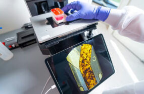 Organ Chips