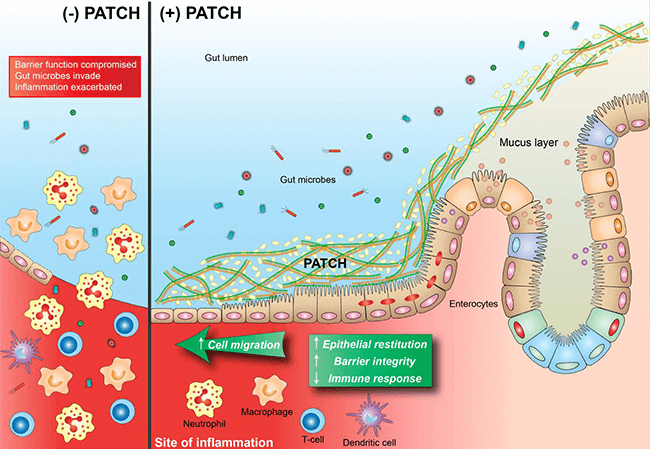 Illustration of the epithelial barrier showing how engineered probiotic bacteria help to maintain gut barrier function, even in the presence of inflammatory insults.